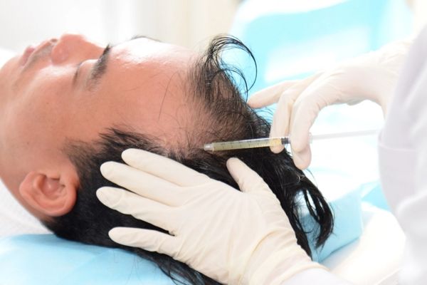 Làm PRP bao lâu mọc tóc: Thời gian, hiệu quả và giải pháp tối ưu