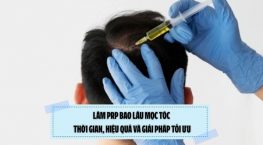 Làm PRP bao lâu mọc tóc: Thời gian, hiệu quả và giải pháp tối ưu