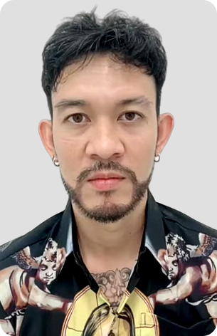 cấy tóc trị hói