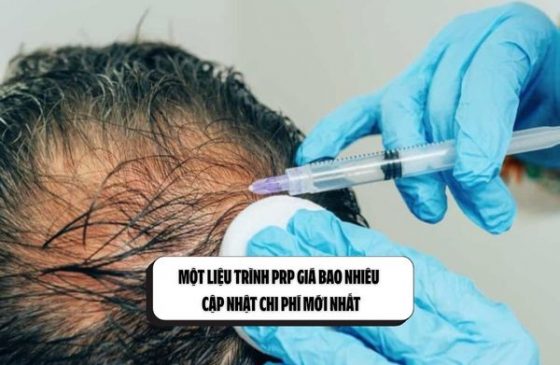 Một liệu trình PRP giá bao nhiêu – Cập nhật chi phí mới nhất