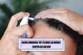 Ngưng Minoxidil tóc có rụng lại không? Chuyên gia giải đáp