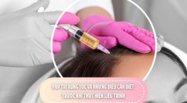 PRP trị rụng tóc và những điều cần biết trước khi thực hiện liệu trình