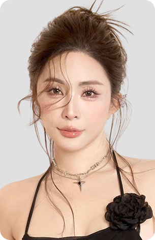 cấy tóc trị hói