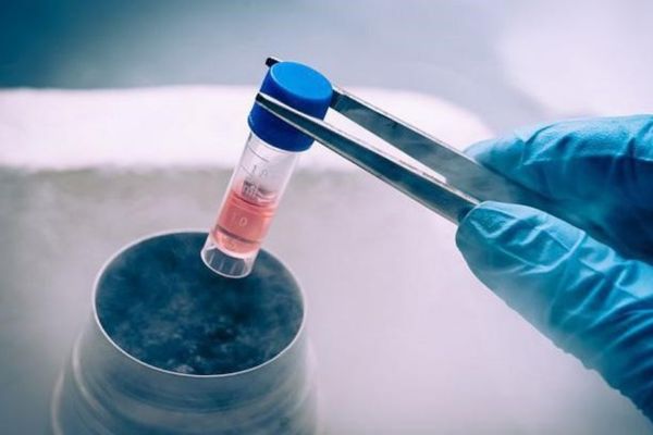 Cấy tóc bằng tế bào gốc: Thực hư hiệu quả và giải pháp phục hồi tóc an toàn Cấy tóc bằng tế bào gốc: Thực hư hiệu quả và giải pháp phục hồi tóc an toàn