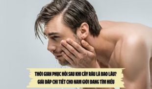 Thời gian phục hồi sau khi cấy râu là bao lâu? – Giải đáp chi tiết cho nam giới đang tìm hiểu