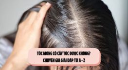 Tóc mỏng có cấy tóc được không? Chuyên gia giải đáp từ A – Z