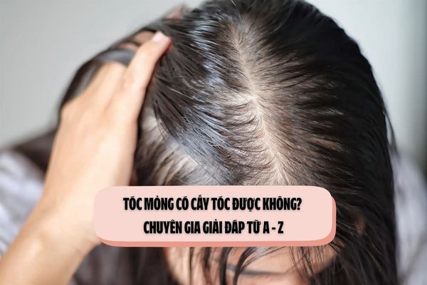 Tóc mỏng có cấy tóc được không? Chuyên gia giải đáp từ A - Z