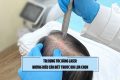 Trị rụng tóc bằng laser: Những điều cần biết trước khi lựa chọn