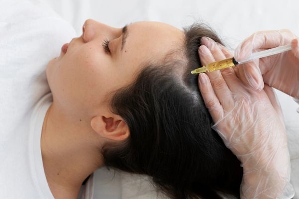 Cấy tóc bằng tế bào gốc: Thực hư hiệu quả và giải pháp phục hồi tóc an toàn