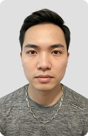 cấy tóc trị hói