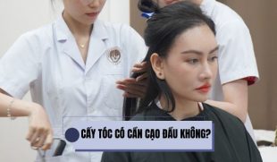 Cấy tóc có phải cạo đầu không? Hướng dẫn lựa chọn phương pháp phù hợp