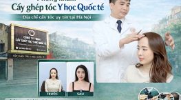 Phòng khám Cấy ghép tóc Y học Quốc tế – Địa chỉ cấy tóc uy tín tại Hà Nội