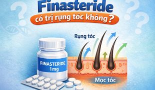 Finasteride có trị rụng tóc không? Giải đáp từ chuyên gia và những điều cần biết