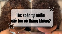 Tóc xoăn tự nhiên cấy tóc có thẳng không? Những điều cần biết trước khi cấy tóc
