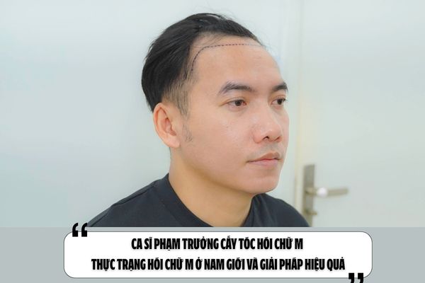 Ca sĩ Phạm Trưởng cấy tóc hói chữ M – Thực trạng hói chữ M ở nam giới và giải pháp hiệu quả
