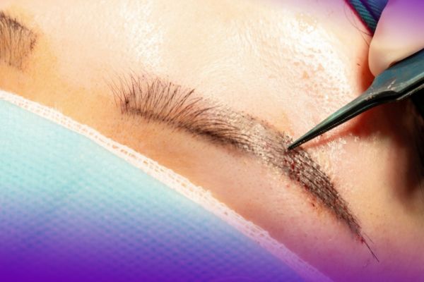 Biến chứng khi cấy chân mày: Hệ lụy khôn lường từ những ca cấy kém an toàn