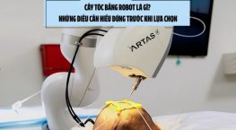 Cấy tóc bằng robot là gì? Những điều cần hiểu đúng trước khi lựa chọn