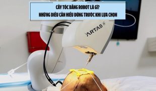Cấy tóc bằng robot là gì? Những điều cần hiểu đúng trước khi lựa chọn