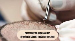 Cấy tóc duy trì được bao lâu? Sự thật bạn cần biết trước khi thực hiện