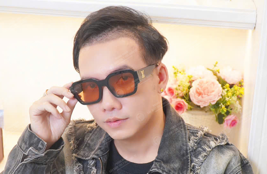 Ca sĩ Phạm Trưởng - Cấy tóc đường chữ M 7