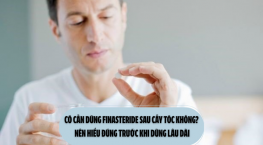 Có cần dùng finasteride sau cấy tóc không? Nên hiểu đúng trước khi dùng lâu dài
