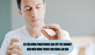 Có cần dùng finasteride sau cấy tóc không? Nên hiểu đúng trước khi dùng lâu dài