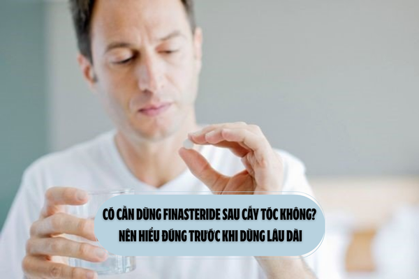 Có cần dùng finasteride sau cấy tóc không? Nên hiểu đúng trước khi dùng lâu dài