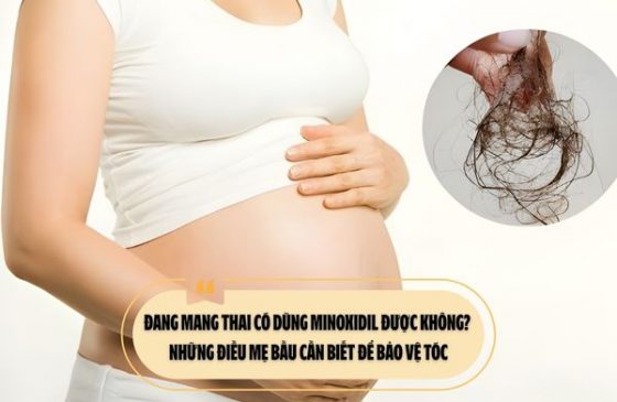 Đang mang thai có dùng Minoxidil được không? Những điều mẹ bầu cần biết để bảo vệ tóc