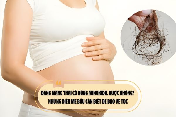 Đang mang thai có dùng Minoxidil được không? Những điều mẹ bầu cần biết để bảo vệ tóc