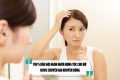 TOP 5 Dầu gội ngăn ngừa rụng tóc cho nữ được chuyên gia khuyên dùng