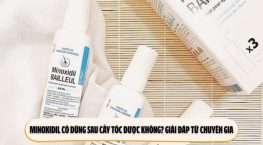 Minoxidil có dùng sau cấy tóc được không? Giải đáp từ chuyên gia
