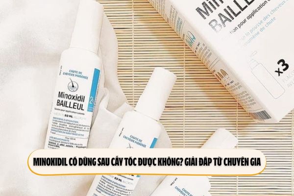 Minoxidil có dùng sau cấy tóc được không? Giải đáp từ chuyên gia Minoxidil có dùng sau cấy tóc được không? Giải đáp từ chuyên gia