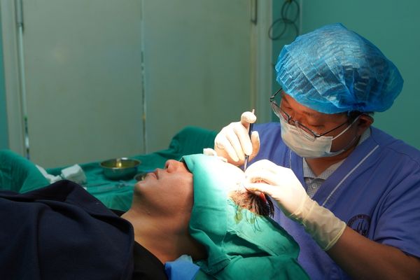 Ca sĩ Phạm Trưởng cấy tóc hói chữ M – Thực trạng hói chữ M ở nam giới và giải pháp hiệu quả