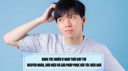 Rụng tóc nhiều ở nam tuổi dậy thì: Nguyên nhân, dấu hiệu và giải pháp phục hồi tóc hiệu quả