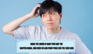 Rụng tóc nhiều ở nam tuổi dậy thì: Nguyên nhân, dấu hiệu và giải pháp phục hồi tóc hiệu quả