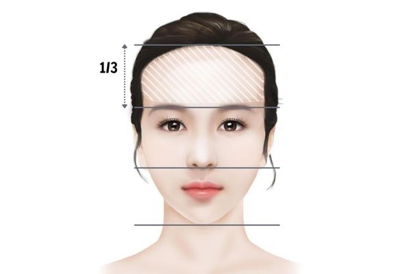 Cấy tóc cho người trán cao: Lựa chọn giúp gương mặt hài hòa hơn mỗi ngày Cấy tóc cho người trán cao: Lựa chọn giúp gương mặt hài hòa hơn mỗi ngày