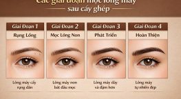 Các giai đoạn mọc lông mày sau cấy ghép: Diễn biến và lưu ý chăm sóc