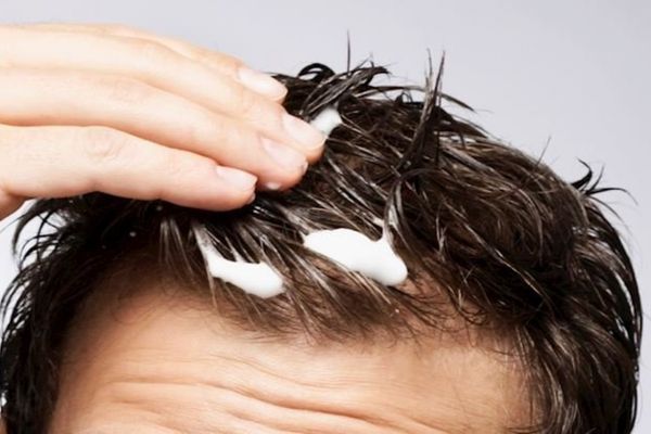 Dùng gel/sáp vuốt tóc sau khi cấy tóc được không? Chuyên gia giải đáp chi tiết 