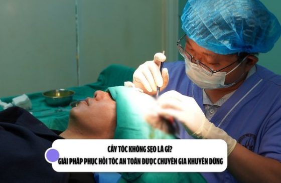 Cấy tóc không sẹo là gì? Giải pháp phục hồi tóc an toàn được chuyên gia khuyên dùng