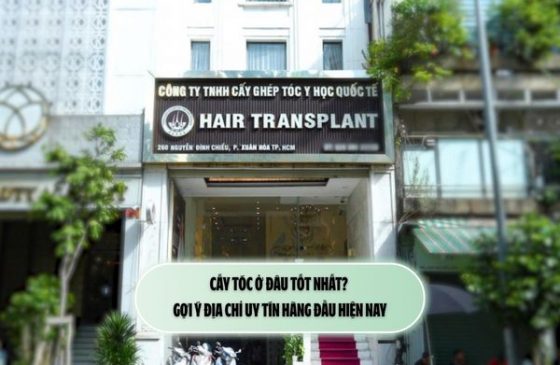 Cấy tóc ở đâu tốt nhất? Gợi ý địa chỉ uy tín hàng đầu hiện nay