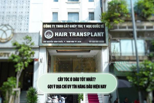 Cấy tóc ở đâu tốt nhất? Gợi ý địa chỉ uy tín hàng đầu hiện nay