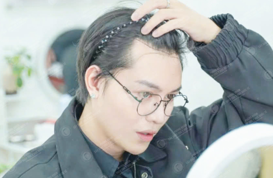 Cường Jin - Cấy tóc đường chữ M 3