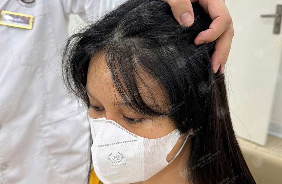 Lê Ngọc Hân - Cấy tóc đường chữ M 6