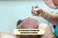 Cấy tóc xong cần lưu ý gì để nhanh lành? Hướng dẫn chi tiết từ chuyên gia