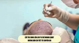 Cấy tóc xong cần lưu ý gì để nhanh lành? Hướng dẫn chi tiết từ chuyên gia