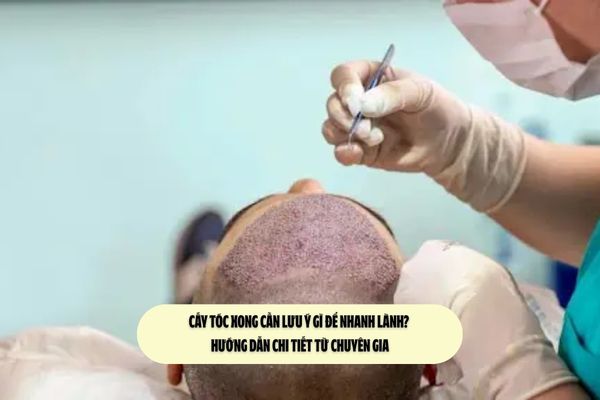 Cấy tóc xong cần lưu ý gì để nhanh lành? Hướng dẫn chi tiết từ chuyên gia