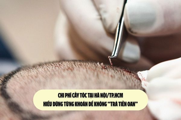 Chi phí cấy tóc tại Hà Nội/TP.HCM: Hiểu đúng từng khoản để không “trả tiền oan”
