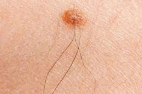 Nhổ râu có sao không? Cảnh báo những tác hại ít ai ngờ tới và giải pháp khắc phục an toàn