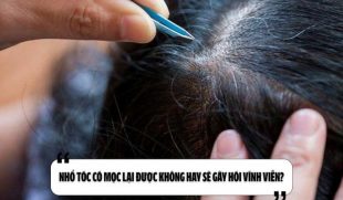 Nhổ tóc có mọc lại được không hay sẽ gây hói vĩnh viễn?