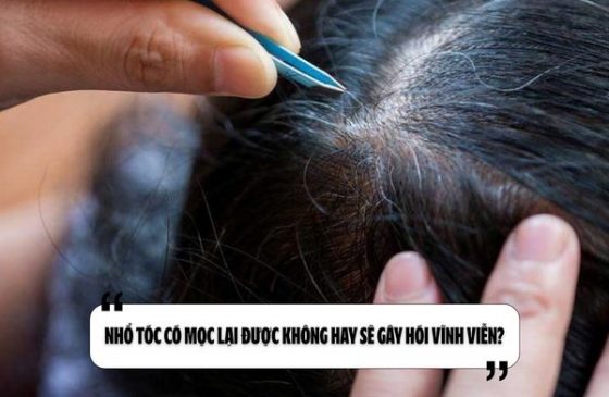 Nhổ tóc có mọc lại được không hay sẽ gây hói vĩnh viễn?